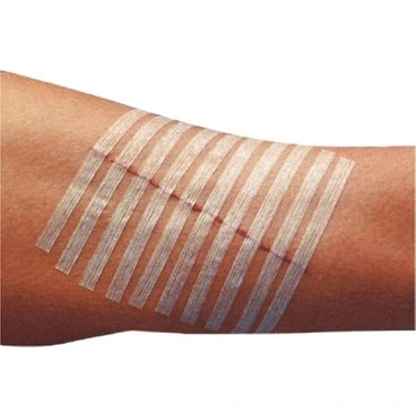 Surgical Tape